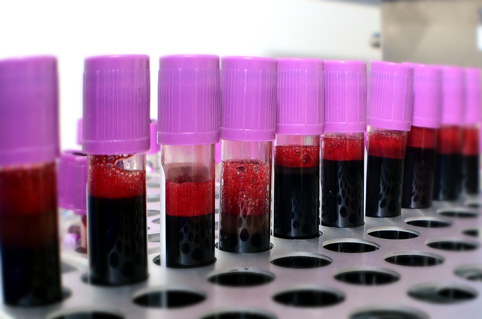 Blood Products (credit: Pixabay License Free for commercial use No attribution required)